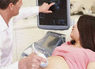 ultrasonda bebek ne zaman görülür