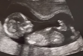 My Ultrasound Baby -  Smile & Carry On 