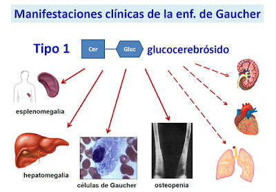 BR-Lab Genomics : Enfermedades Metabólicas Congénitas: Enfermedad de ...