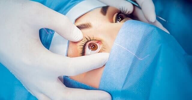 Lasik göz ameliyatı