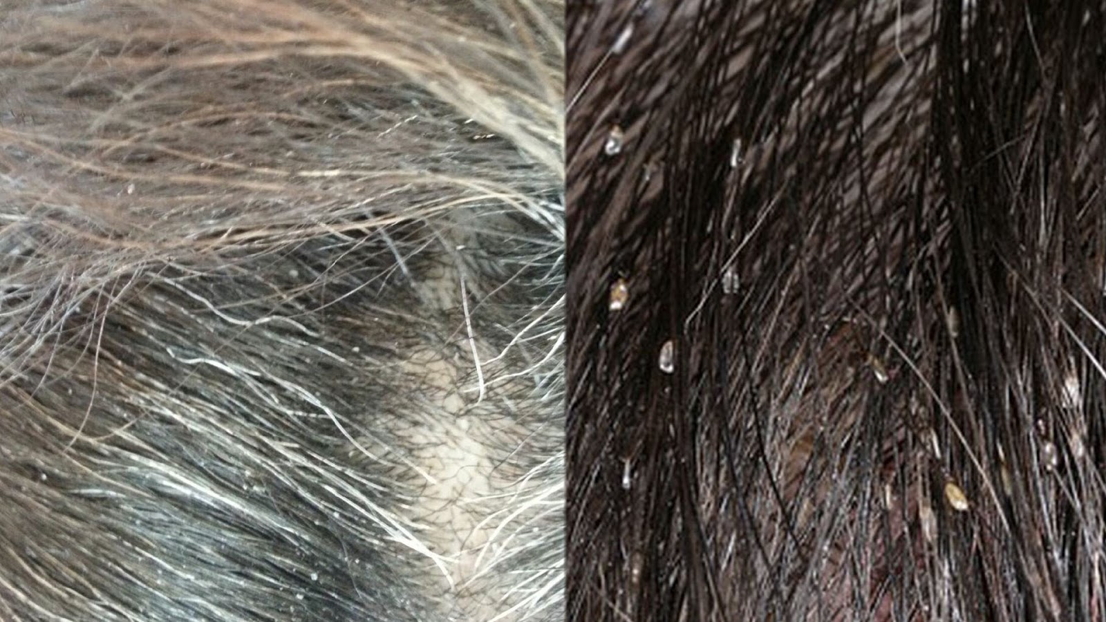 My Dogs Liked A Spot Sore Whats The Best Treatment My Dogs Liked A Spot Sore Whats The Best Treatment