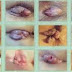 Obat Ambeien Masuk Dubur thumbnail