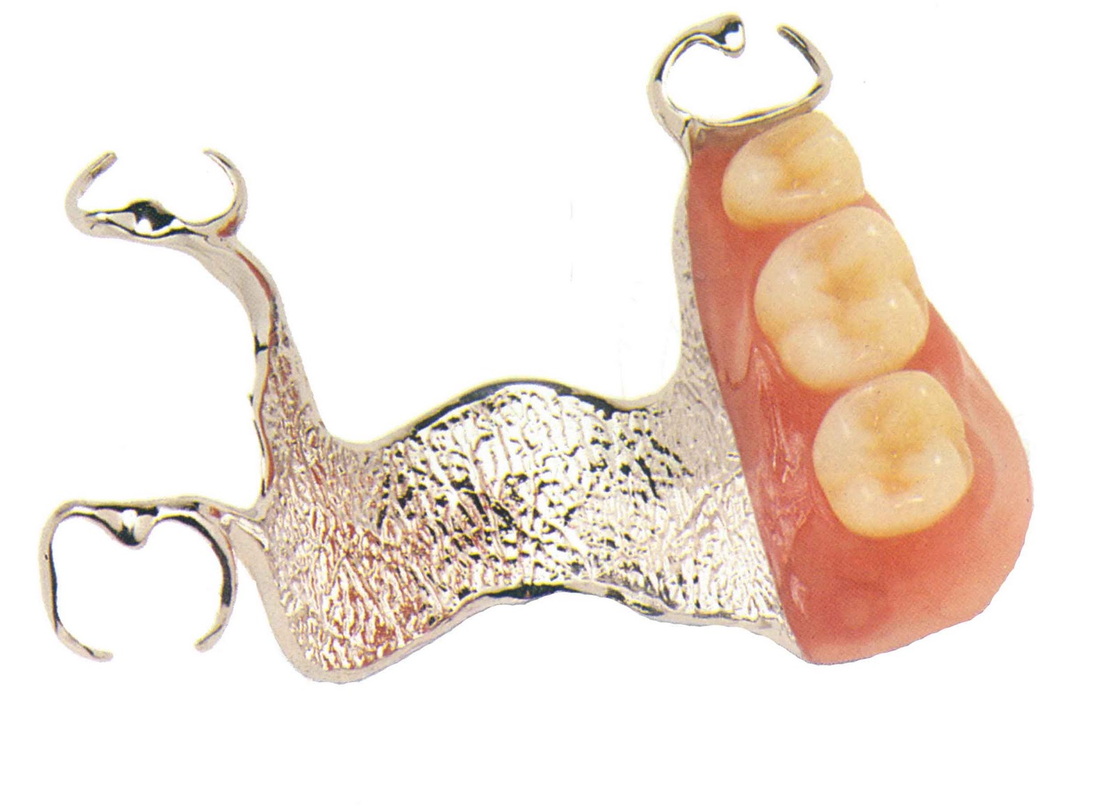 News Room ROE Dental Laboratory RestoreRefresh your Patient’s