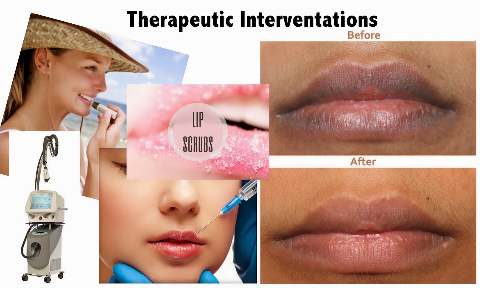 Treatments For Dark Lips