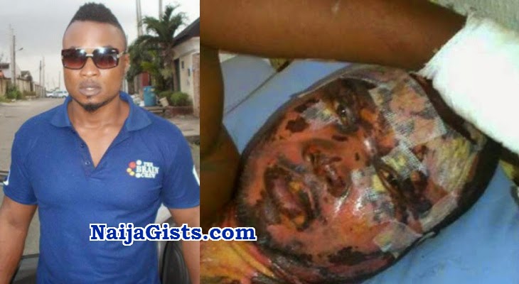 von apochi fire accident