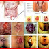 Obat Tradisional Untuk Ambeien Parah thumbnail