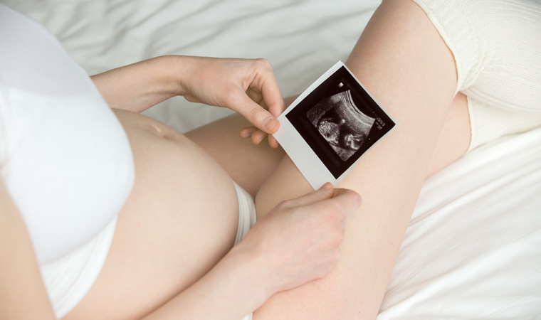 Inseminación Inseminación