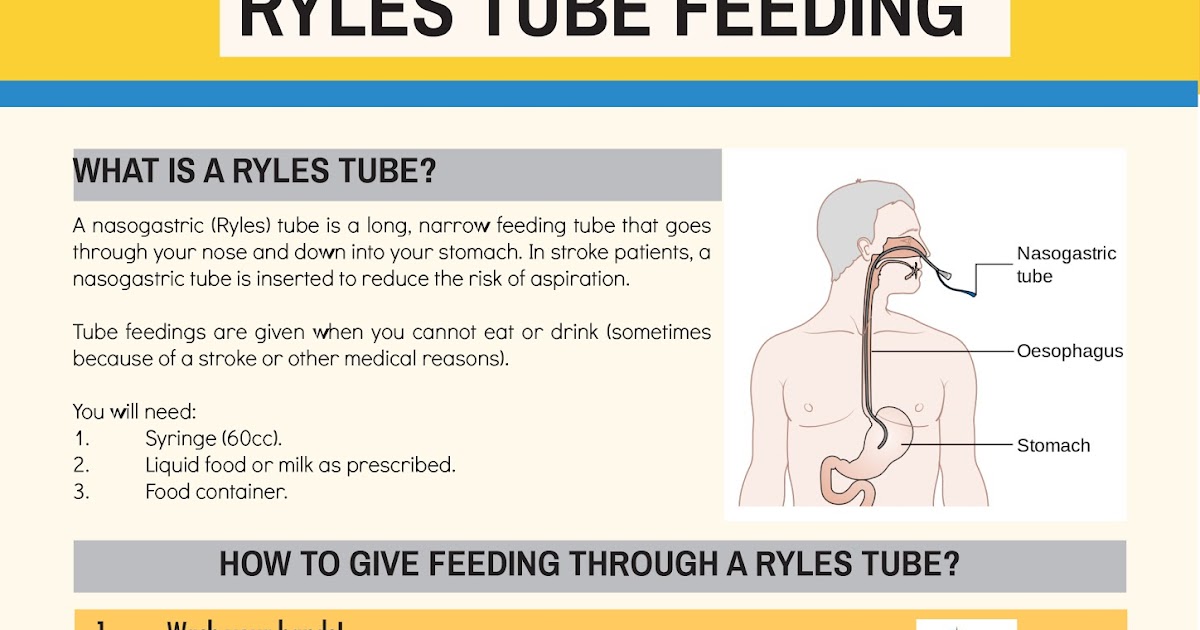 Carer Training Information Ryles Tube Feeding