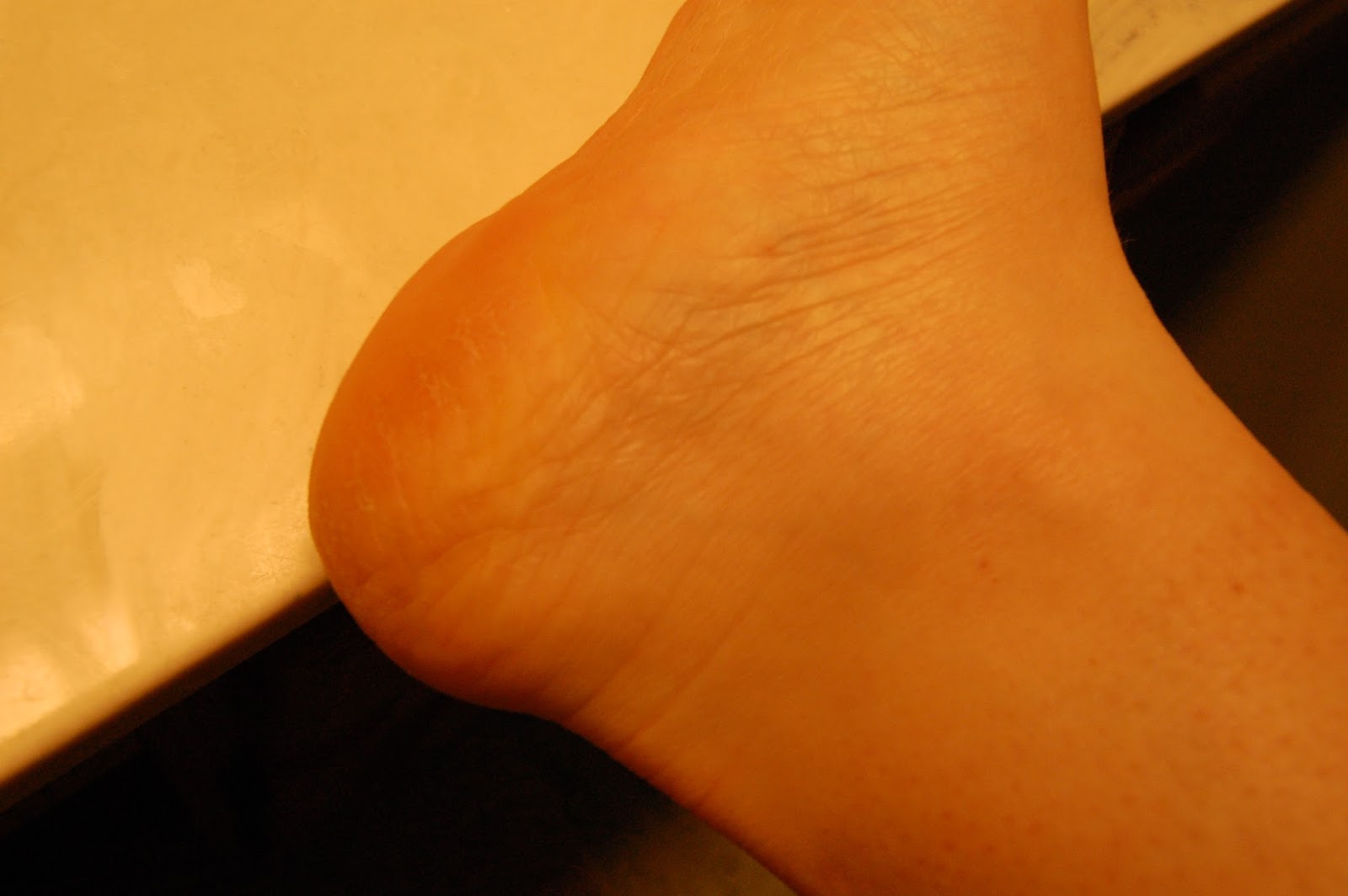 moisturize-those-dry-cracked-hands-and-feet-with-du-it-review-lotion