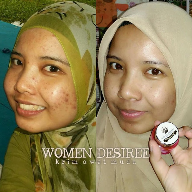 z wdec WD _ nad adleesya beauty _ ainaa serum _ cikgu june _ women desiree _ krim awet muda 39 z wdec WD _ nad adleesya beauty _ ainaa serum _ cikgu june _ women desiree _ krim awet muda 39