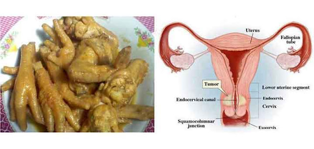 Waspadailah-Bahaya-Sayap-dan-Ceker-Ayam.