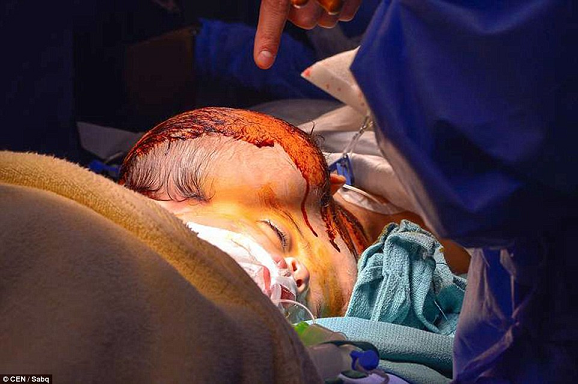 Tuqa & Yakeen surgery successful