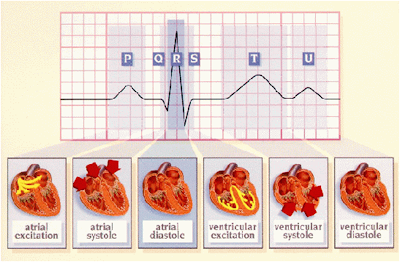 3 Langkah Mudah Interpretasi EKG