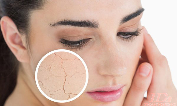 Mẹo trị nứt nẻ dưỡng da khô vào mùa đông Mẹo trị nứt nẻ dưỡng da khô vào mùa đông