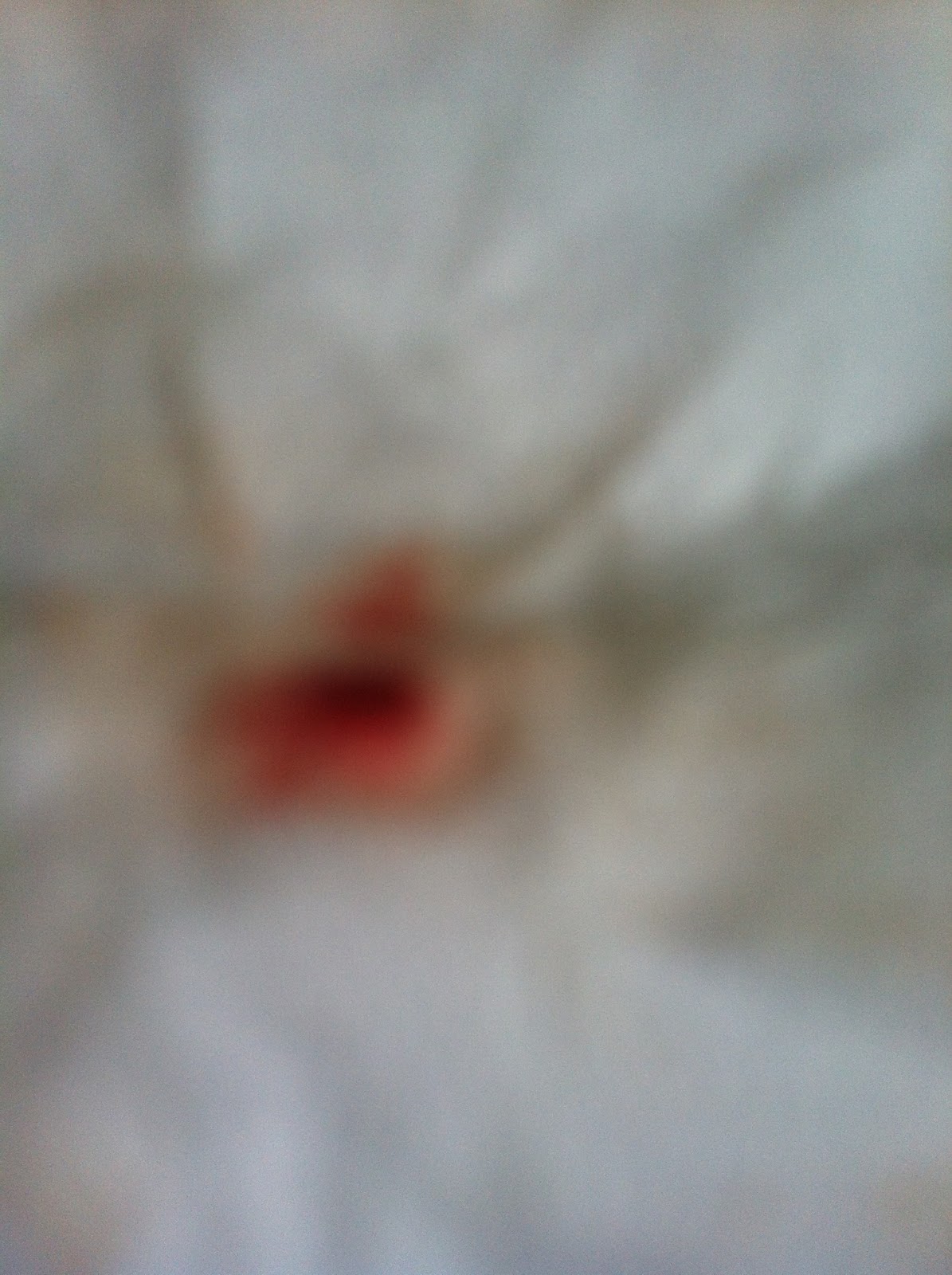 A Guide to Surviving Orthognathic Surgery Recovering from Double Jaw