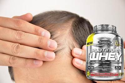 La Whey protein no siempre causa la pérdida de cabello en hombres