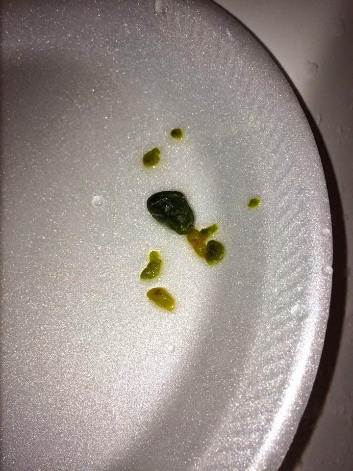 Stay Well Sunshine Lindsay Stay Beachbody Coach Gall Bladder/Liver