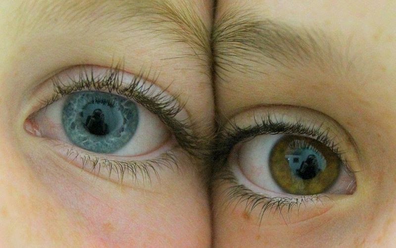5 Exercitii Pentru Ochi - Imbunatatirea Vederii Fara Ochelari | PDF