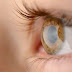 Panduan Perawatan Mata Setelah Operasi LASIK