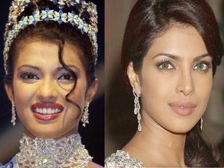 Bollywood Actress Are Becoming Beautiful After Plastic Surgery - See