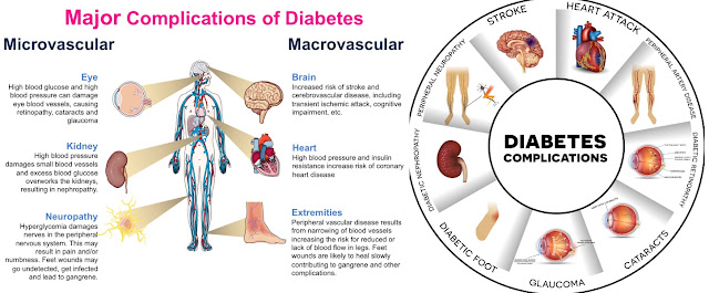 complications of diabetes Diabetes complications almost every part of the body can be affected by the complications of diabetes, including the heart, eyes, blood vessels, teeth, and skin examples of long-term complications include blindness, kidney failure, stroke, and sexual problems. complications of diabetes Diabetes complications almost every part of the body can be affected by the complications of diabetes, including the heart, eyes, blood vessels, teeth, and skin examples of long-term complications include blindness, kidney failure, stroke, and sexual problems.