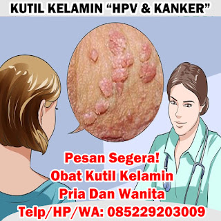 Obat Kutil Kelamin Obat Kutil Kelamin