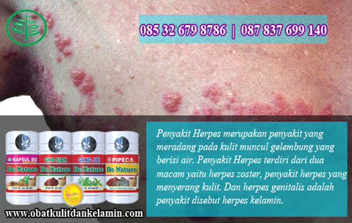 Foto Ciri Ciri Penyakit Herpes Muncul Di Selangkangan