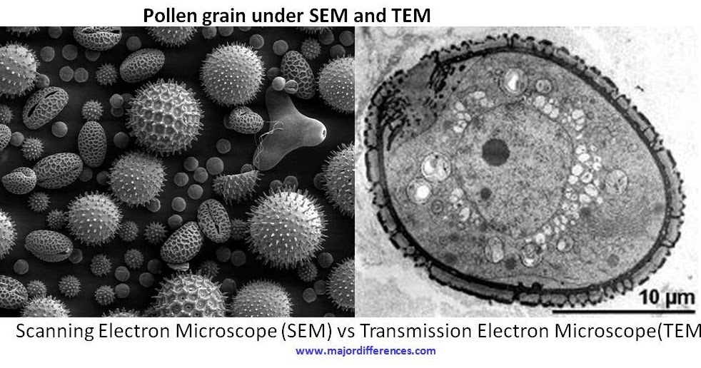 transmission electron microscopy