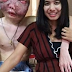 Thai Lady Stands By Her Boyfriend Even When Tumor & Cancer Has Disfigured His Face - Very Graphic