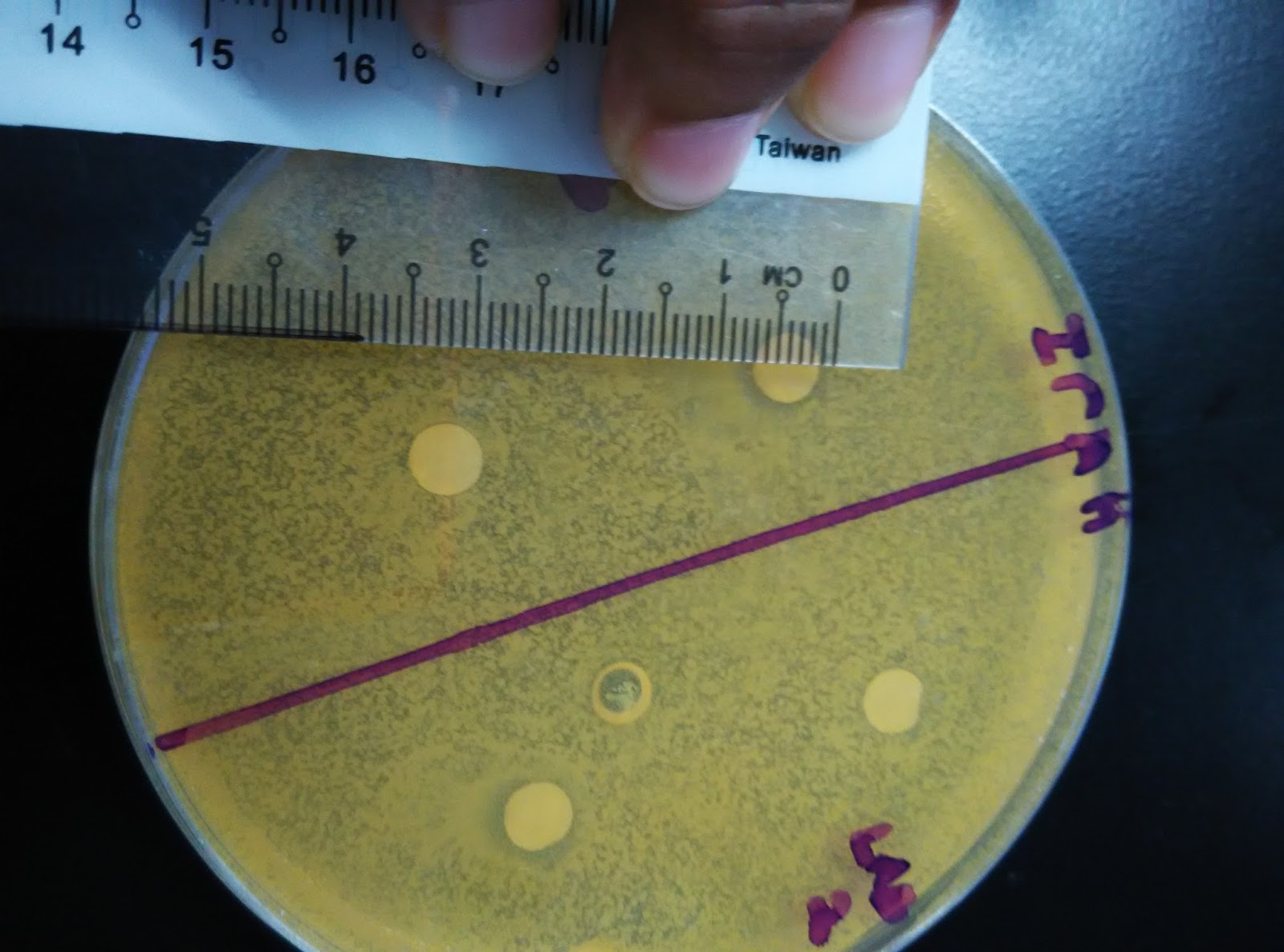 BIOLOGY FOR TECHNOLOGIST LAB REPORT LAB 5 DETERMINATION OF