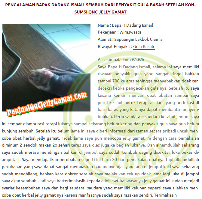 Cara Mengobati Luka Diabetes Basah Secara Alami Terbukti Mujarab ~ Testimoni QNC JELLY GAMAT Cara Mengobati Luka Diabetes Basah Secara Alami Terbukti Mujarab ~ Testimoni QNC JELLY GAMAT