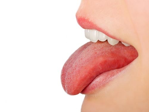 Tìm hiểu bệnh viêm amidan lưỡi là gì ?