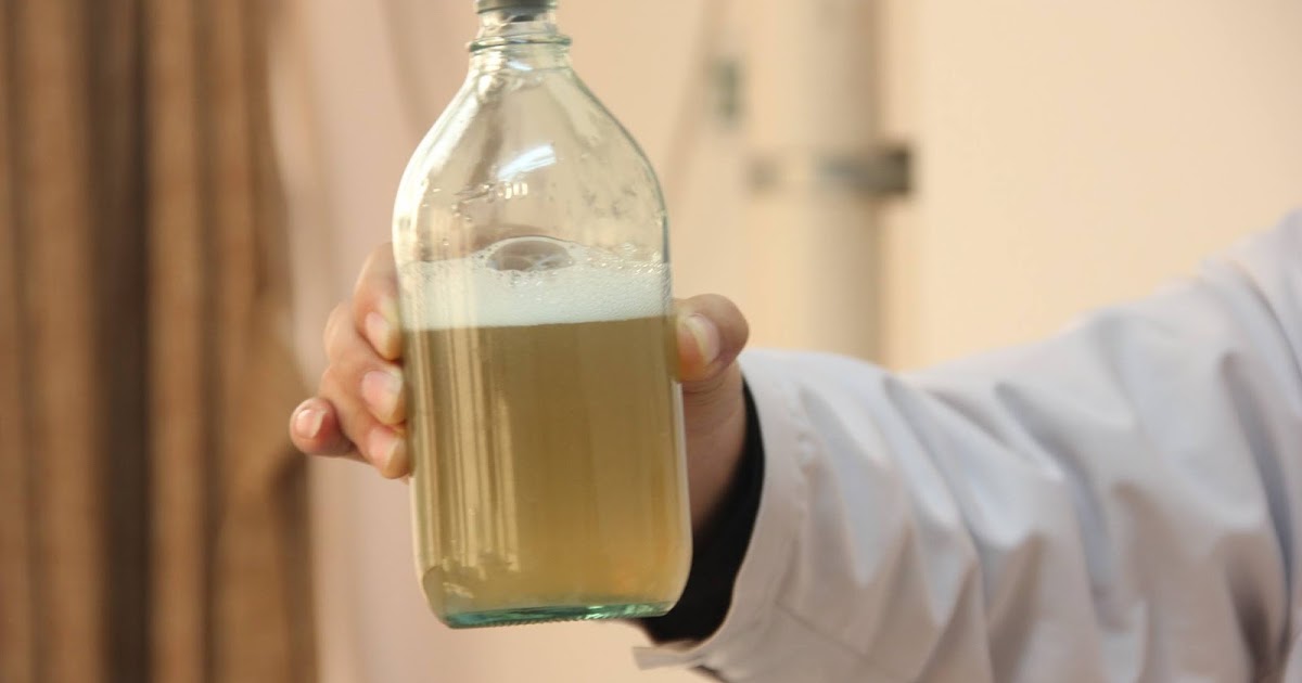 Does foamy urine mean the recurrence of kidney disease?