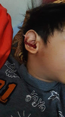 Cara membersihkan telinga anak yang benar.