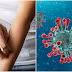 SKIN RASHES MAY BE SYMPTOM OF CORONAVIRUS, SCIENTISTS SAY