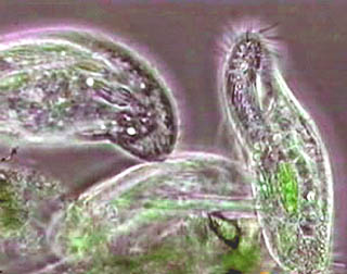 Bahri Sains Protozoa 