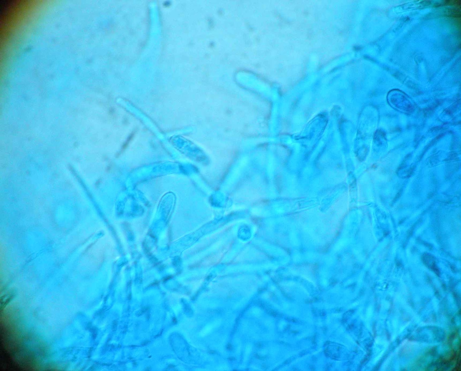 Epidermophyton floccosum