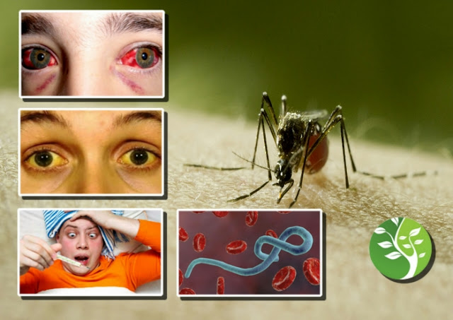 mejores remedios caseros fiebre hemorrágica (Dengue, Ébola, Lassa, Marburg, Fiebre amarilla)