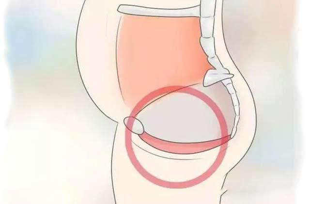 Bà mẹ mới sinh hãy hiểu và chăm sóc cơ thể tránh những bệnh lý hậu sản Bà mẹ mới sinh hãy hiểu và chăm sóc cơ thể tránh những bệnh lý hậu sản
