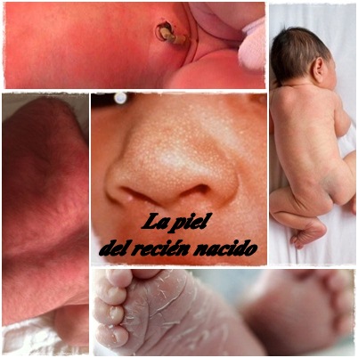piel levantada bebe