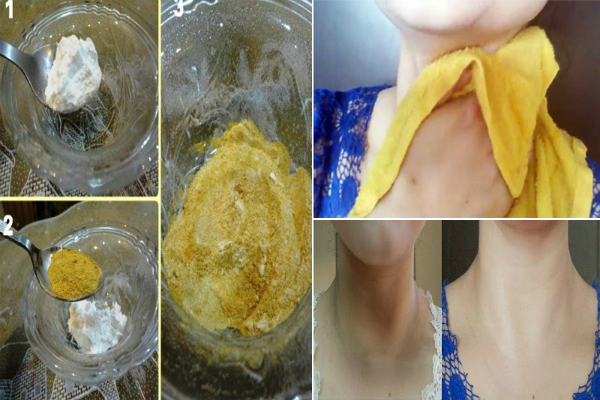 ¿Cómo deshacerse de la oscuridad del cuello en 20 Minutos ¿Cómo deshacerse de la oscuridad del cuello en 20 Minutos