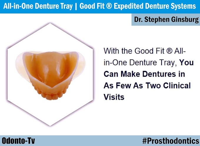 COMPLETE DENTURE: All-in-One Denture Tray | Good Fit ® Expedited Denture Systems