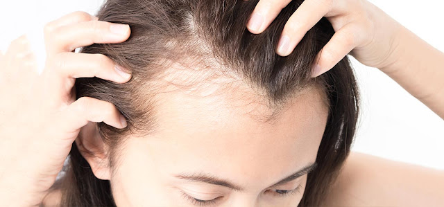 hair fall problems, remedies for hairfall
