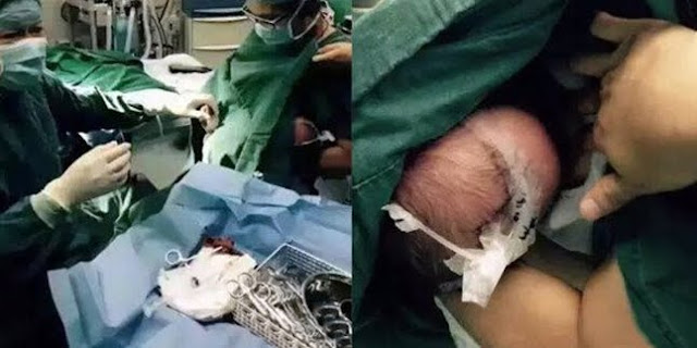 Foto saat Suster sedang Menyusui Pasien Lantaran Menangis saat Operasi ini Hebohkan Netizen 