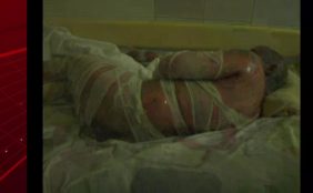 Mujer roció gasolina y luego le lanzó un fósforo a su marido en San Juan de la Maguana