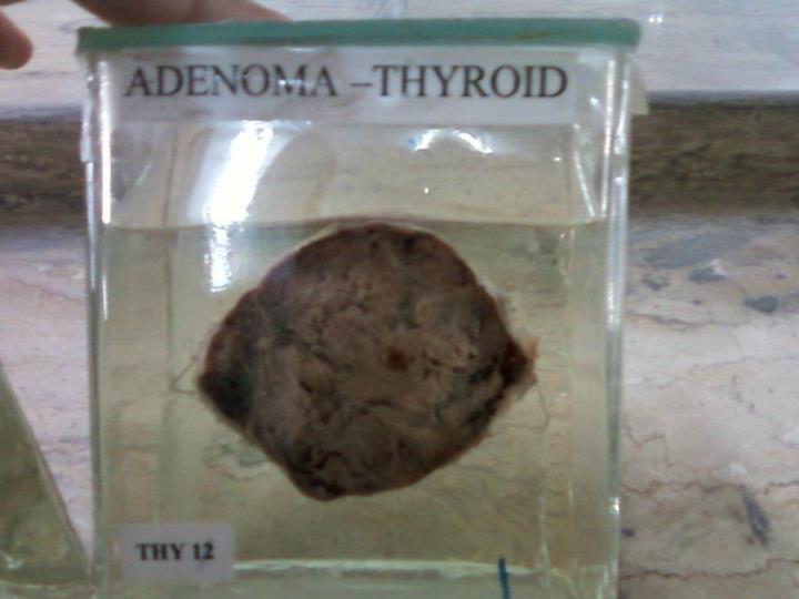 Medical Education for Students Gross Specimens General Pathology (50