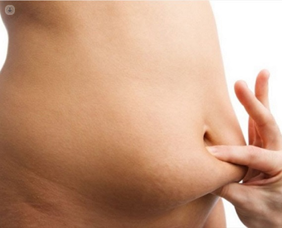 ascites