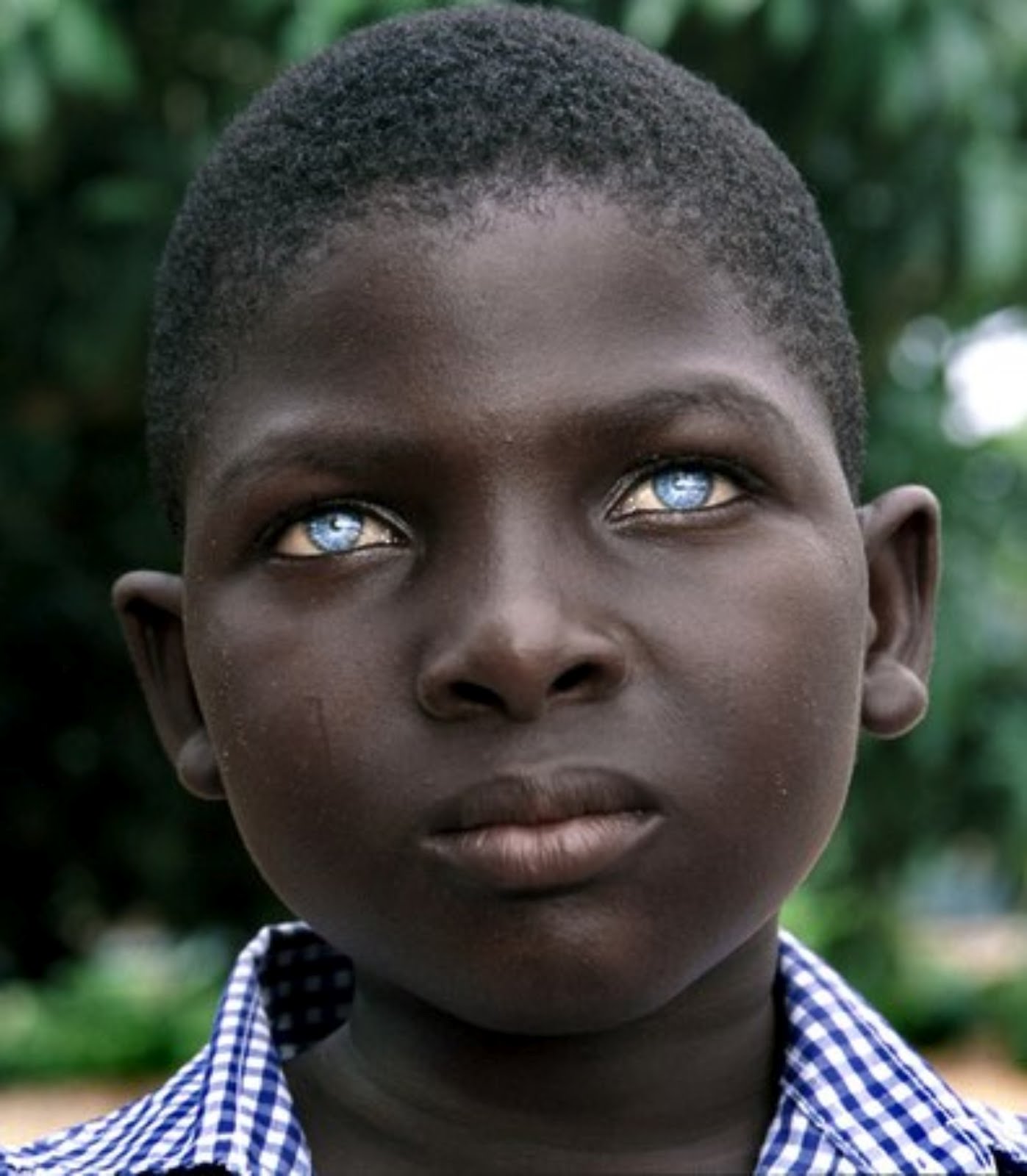 » Black People with Blue Eyes Natural Phenomenon or