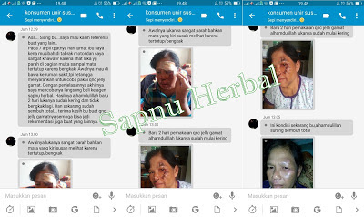 TERBUKTI ! 6 Bahan Alami Ini Bisa Percepat Penyembuhan Luka TERBUKTI ! 6 Bahan Alami Ini Bisa Percepat Penyembuhan Luka