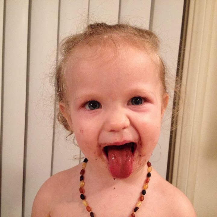 The Breastfeeding Mother Tongue tie and Low Weight Gain Tatum's Story